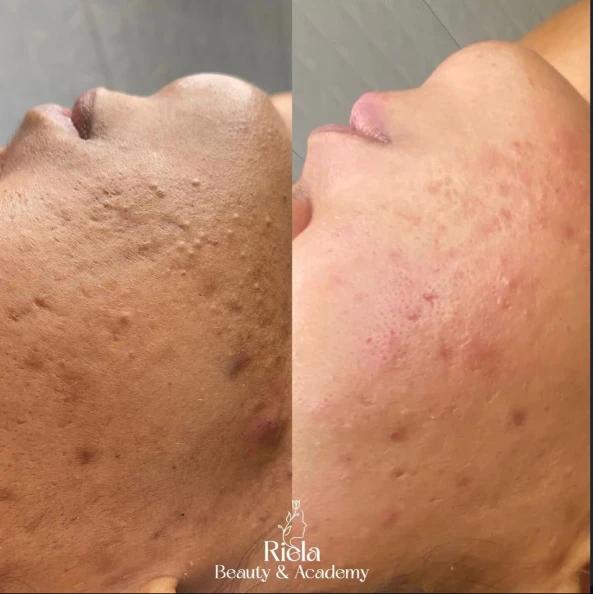 Skin Care Premium - Riela Beauty