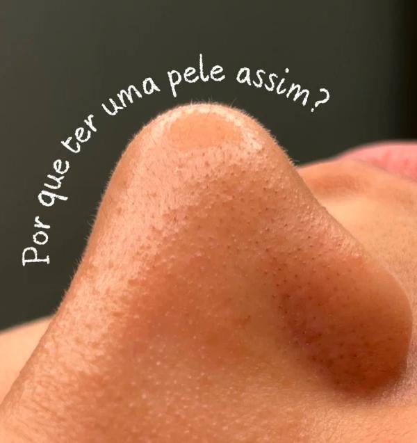 Tratamento de Pele - Riela Beauty